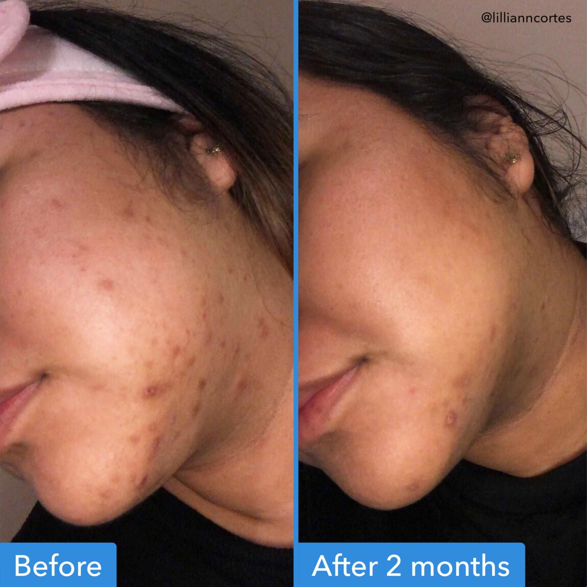 discoloration-correcting-serum-f4 zb_p.jpg